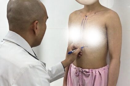 Bác sĩ Bảo Anh: Phẫu thuật cắt ngực, thu gọn vú phì đại