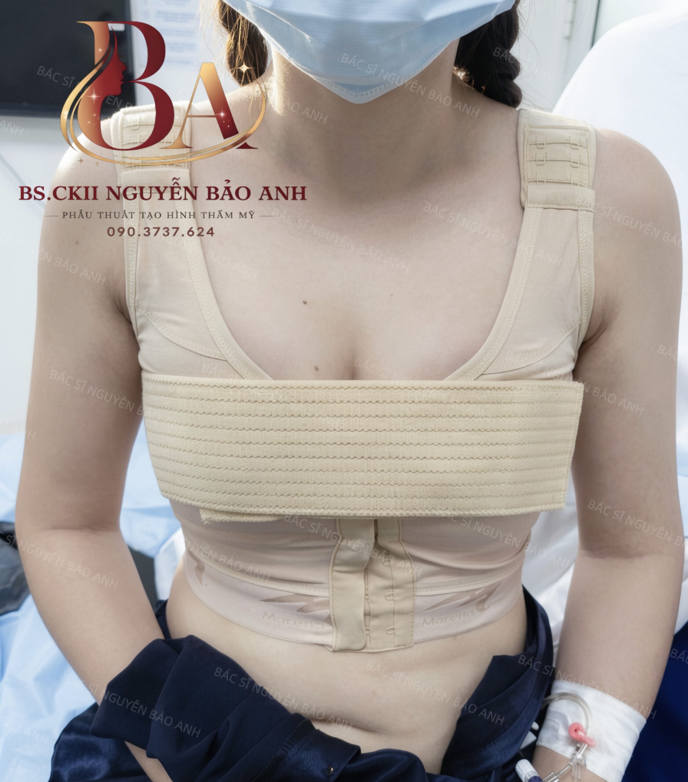 Khách hàng mặc áo định hình chuyên dụng sau phẫu thuật nâng ngực cùng BS Bảo Anh