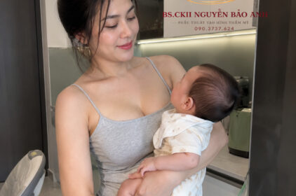 Cho Con Bú Sau Nâng Ngực Có Được Không? 5 Đáp Án Từ BS Bảo Anh